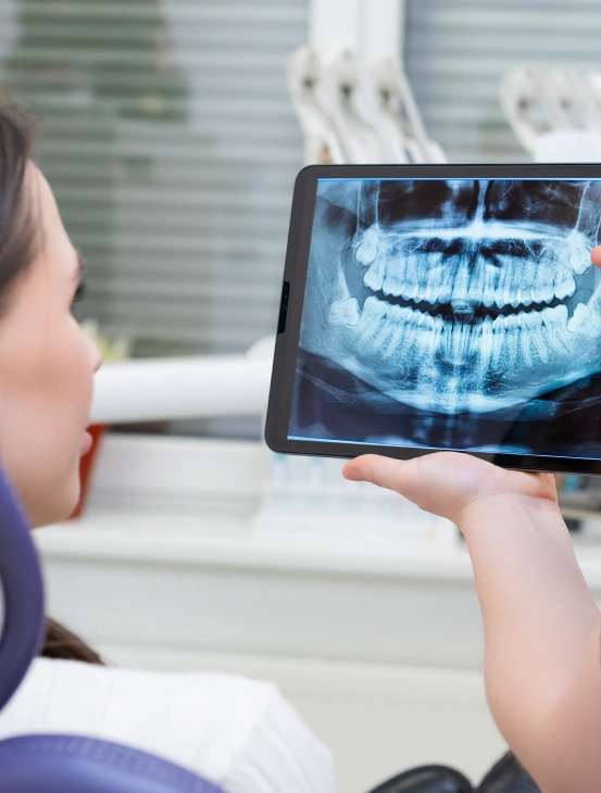 Digital dental X-ray displayed during a patient examination