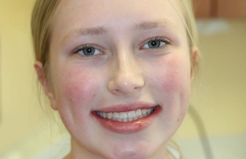 Orthodontics after
