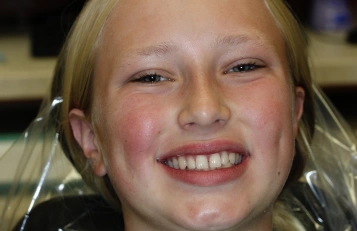 Orthodontics before